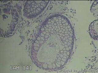 降结肠粘膜图35
