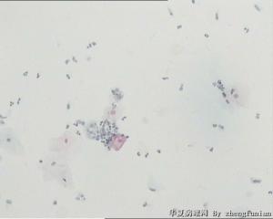 挖空样细胞？图1