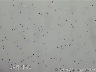 腹水图42