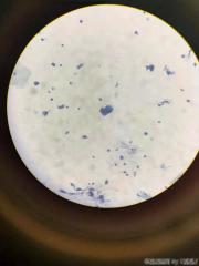 可见非典型林状上皮细胞？图9