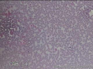 甲状腺细胞学图25