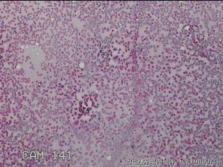 甲状腺细胞学图7