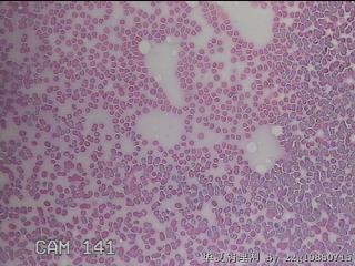 甲状腺细胞学图27