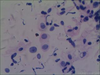 hpv16阳性图6