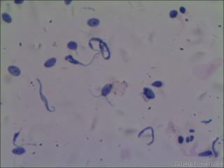 hpv16阳性图1