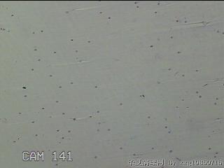 膝关节积液图29