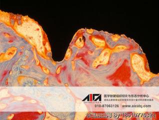 硬组织（不脱钙骨/牙、带植体血管、带植体骨等）病理切片制作流程及周期图3