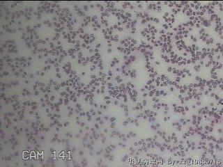 甲状腺穿刺液图2