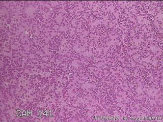甲状腺穿刺液图4