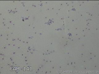 膝关节积液4ml图7