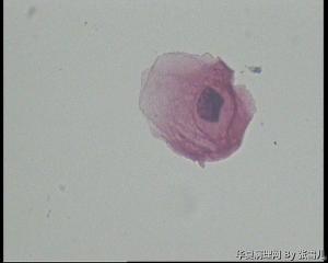 28岁TCT，ASC—US吗？图4