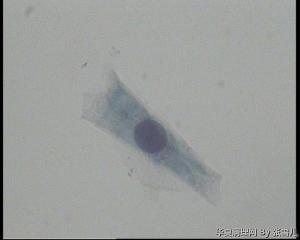 28岁TCT，ASC—US吗？图10