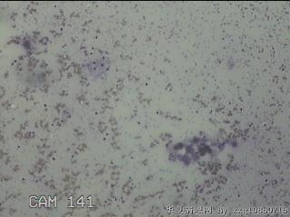 甲状腺细针穿刺涂片图28