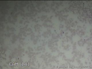 甲状腺细针穿刺涂片图1