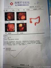 急！！！请老师会诊，Peuta-Jeghers息肉综合征？（胃镜来了，还有粘膜黑色斑点患者图片）图28