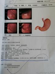急！！！请老师会诊，Peuta-Jeghers息肉综合征？（胃镜来了，还有粘膜黑色斑点患者图片）图27