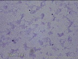 膝关节腔积液11ml图10