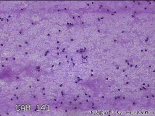 膝关节腔积液12ml图8