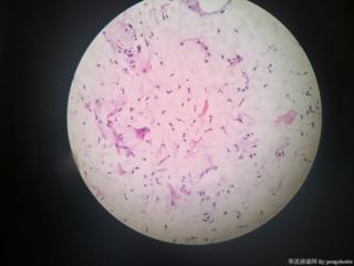 求教各位老师如何诊断？图18