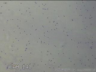 膝关节腔积液5ml图15