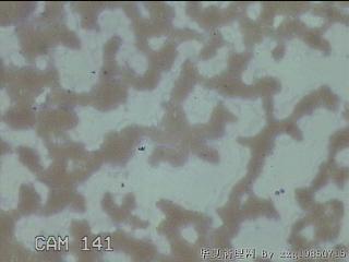 左侧甲状腺细针穿刺涂片图26