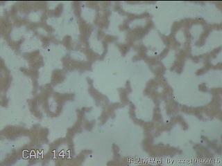 左侧甲状腺细针穿刺涂片图27