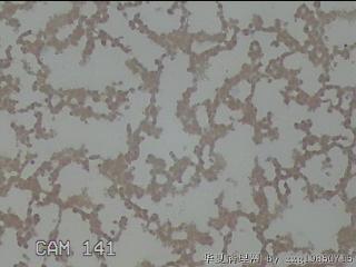 左侧甲状腺细针穿刺涂片图20