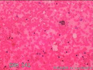 甲状腺细针穿刺涂片图21