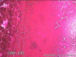 甲状腺细针穿刺涂片图2