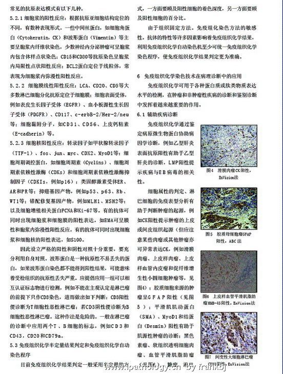 郑杰老师讲座－免疫组化图4