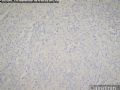 HYUH Case 1 Diagnosis图2