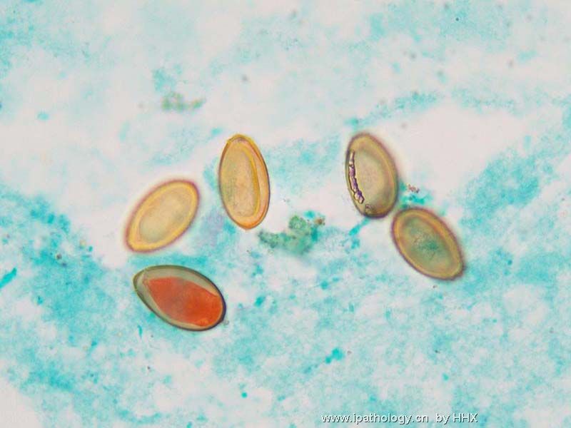 肝 FNA,又是什么虫。图2