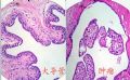 乳腺结节图7