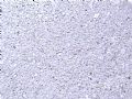 肿瘤？非肿瘤？图13