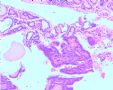 20070703甲状腺冰冻+常规图14
