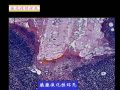病理学2--第一章 细胞和组织的适应与损伤（2）图21