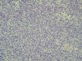 腹股沟淋巴结(会2081)图4