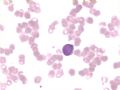 AML-M7图8