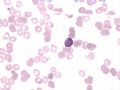 AML-M7图10