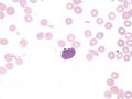 AML-M7图11