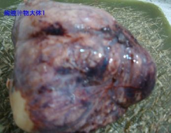 胸腔肿瘤，请老师帮忙给予诊断，谢谢图1