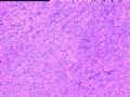 良性?恶性?请指教图3