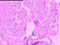 胃窦黏膜图1