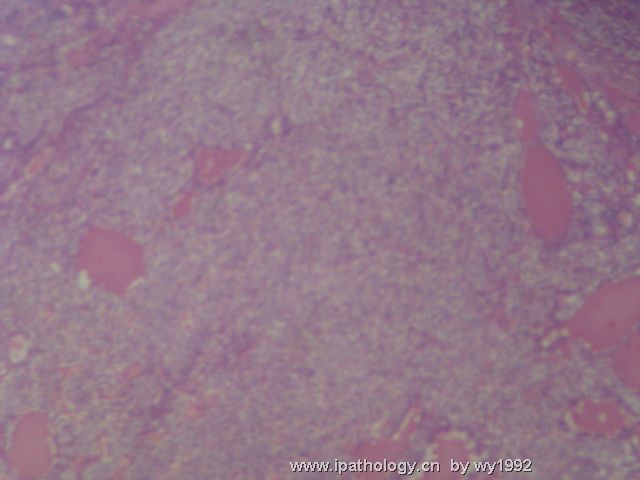 sbquqtrantedeux甲状腺图1