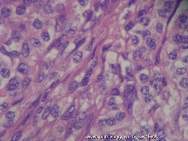 sbquqtrantedeux甲状腺图6