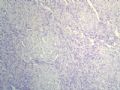 男婴，出生1天，发现下唇巨大包块。图12