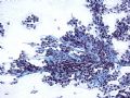 Salivary gland FNA图3