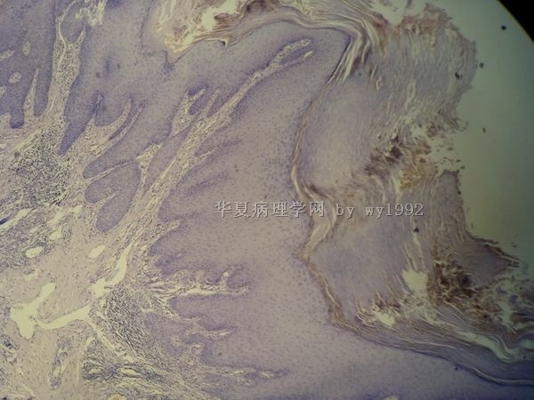 头部赘生物,如何诊断?图8