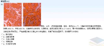 中级试题11-20图10