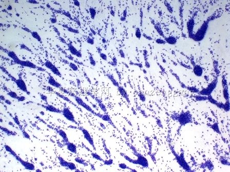 Lymphadenopathy图1
